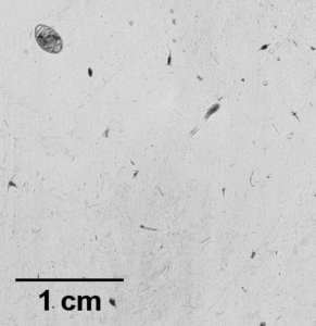 Microscopic view showing various small, irregularly shaped dark particles and specks scattered on a light background, with a scale bar indicating 1 cm in the lower left corner.
