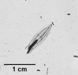 Microscope image of a small, elongated, transparent organism with visible internal structures, resembling a seed or larva. A scale bar at the bottom left indicates a length of 1 cm.